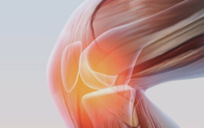 Articulaciones: más allá del desgaste