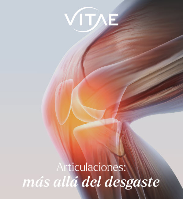 Articulaciones: más allá del desgaste